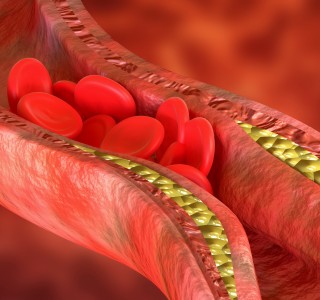 motivate-study.com thrombosis vein